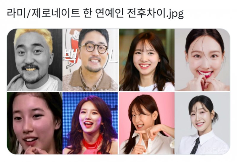 라미/제로네이트 한 연예인들 전후차이.jpg | 인스티즈