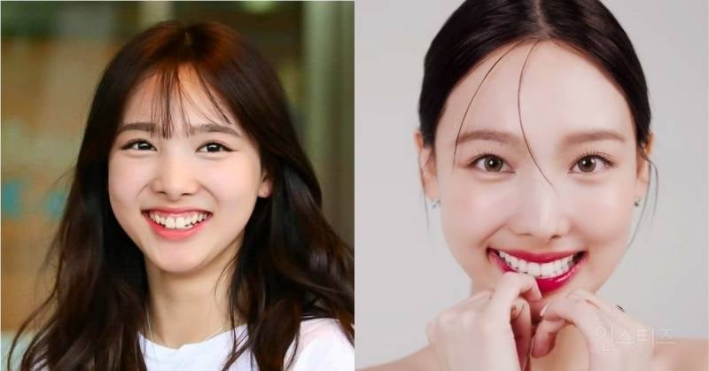 라미/제로네이트 한 연예인들 전후차이.jpg | 인스티즈