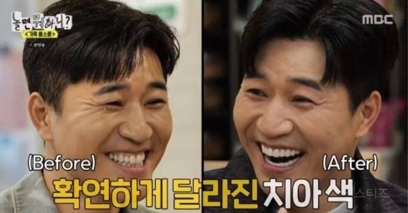 라미/제로네이트 한 연예인들 전후차이.jpg | 인스티즈