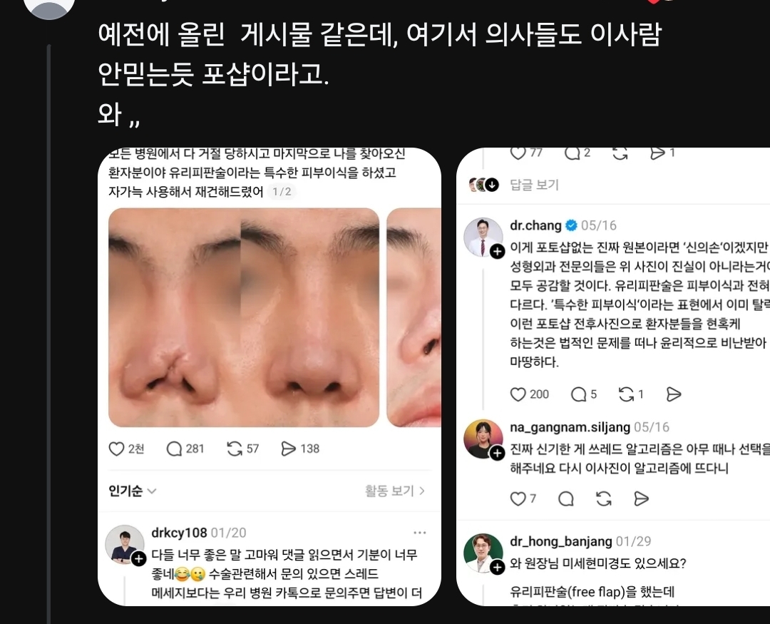 [정보/소식] 코 성형수술 부작용 피해 속출중이라는 강남성형외과 | 인스티즈