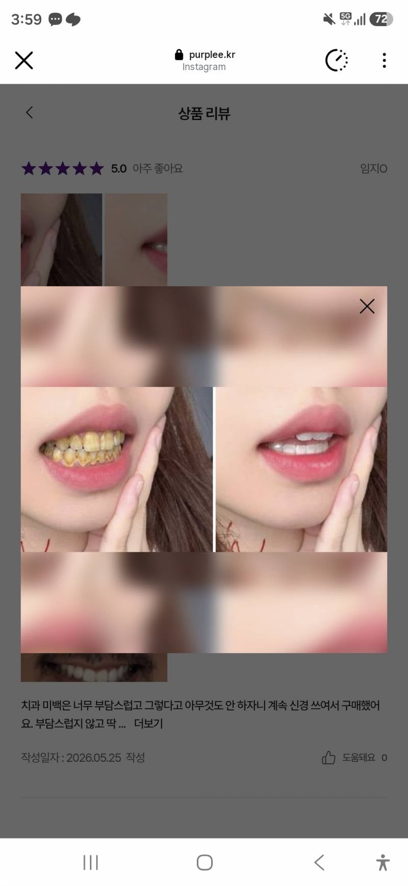 [잡담] 요즘 치아 하얘지는 보라색 치약이랑 가루 그거 다 구라지? | 인스티즈