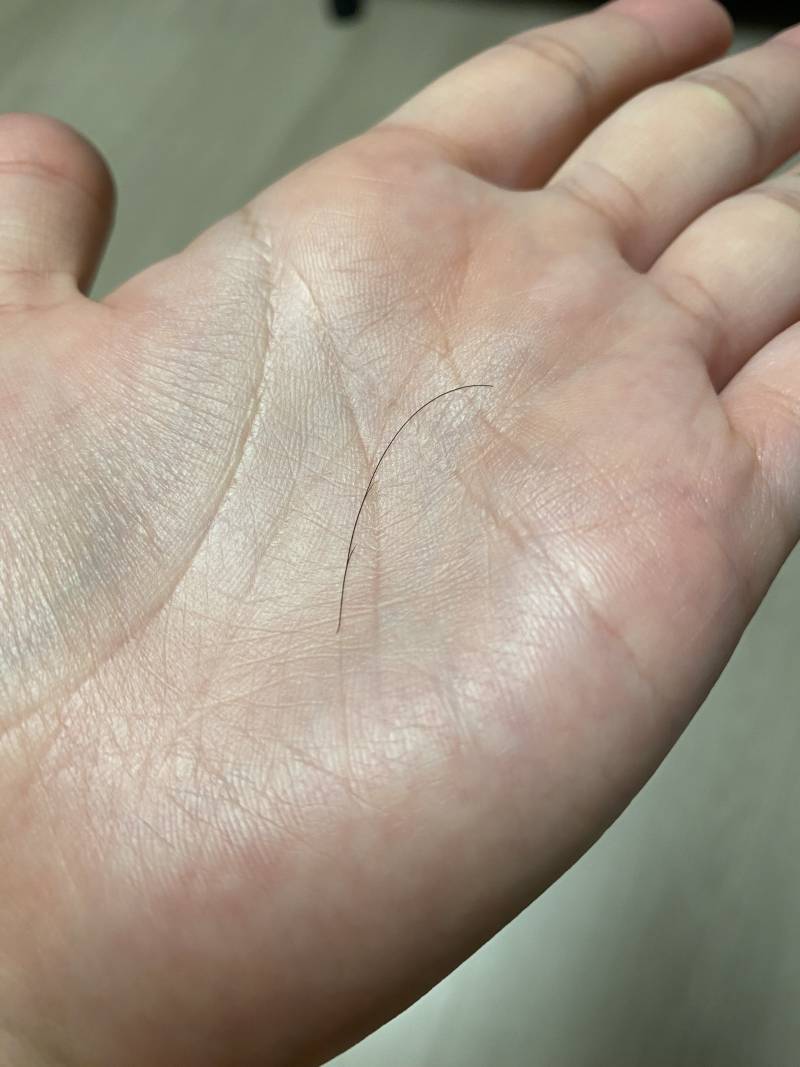 [잡담] 머리가 일케 갈라지는건 왜그런가야? | 인스티즈