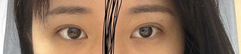 [잡담] 너네라면 뒷밑트임 함?? | 인스티즈