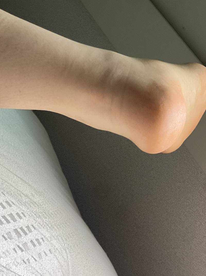 [잡담] 얘들아 살 10키로정도 빼면 발목 얇아질까…ㅋ | 인스티즈