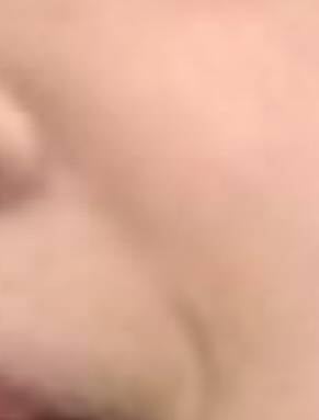 [잡담] 25살인데 팔자주름 너무 심하지 않아? 어케 해결해....??? | 인스티즈