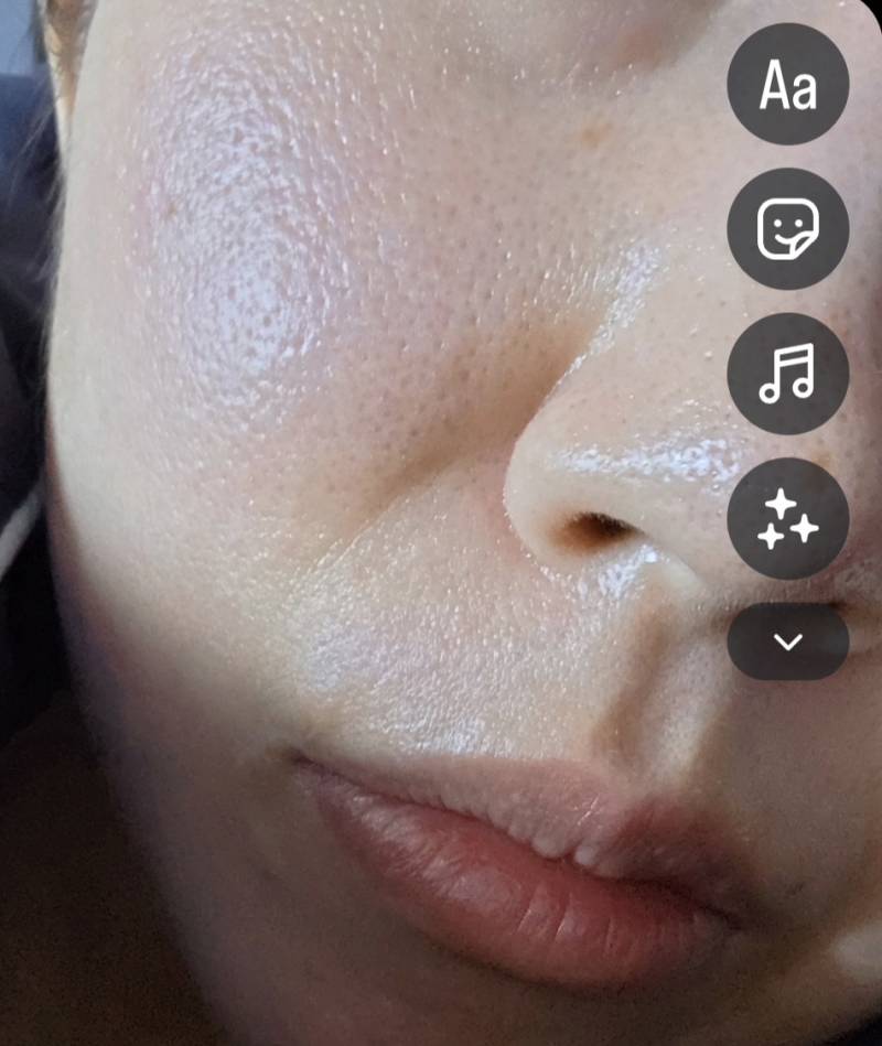 [잡담] 인스타 셀카?버전 잘못눌렀다가 내 피부상태에 개깜놀함 ㅠ(놀람주의) | 인스티즈