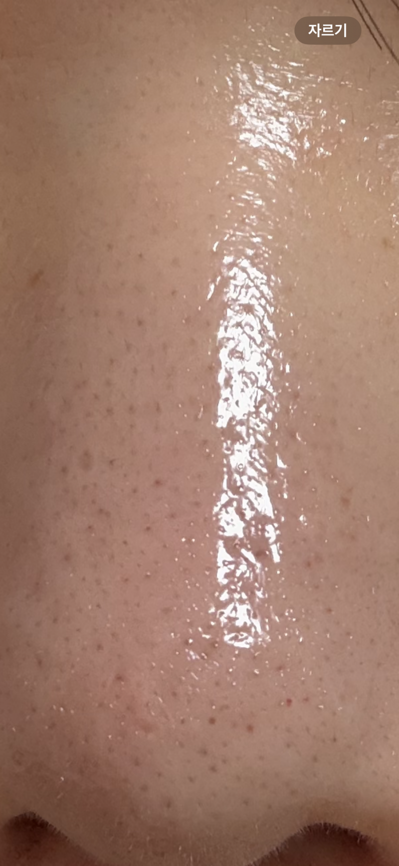 [잡담] ㅎㅇㅈㅇ 이건 레이저 맞아야되는 피부야?? | 인스티즈