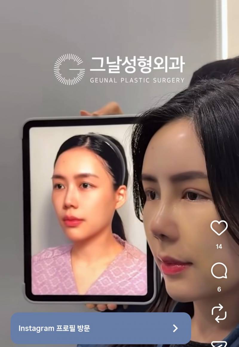 [잡담] 내 미감이 이상한가 나만 성형 전이 나음? | 인스티즈