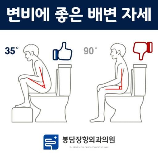 [잡담] 변비,및 배변볼때 힘많이주는 사람들봐봐 | 인스티즈