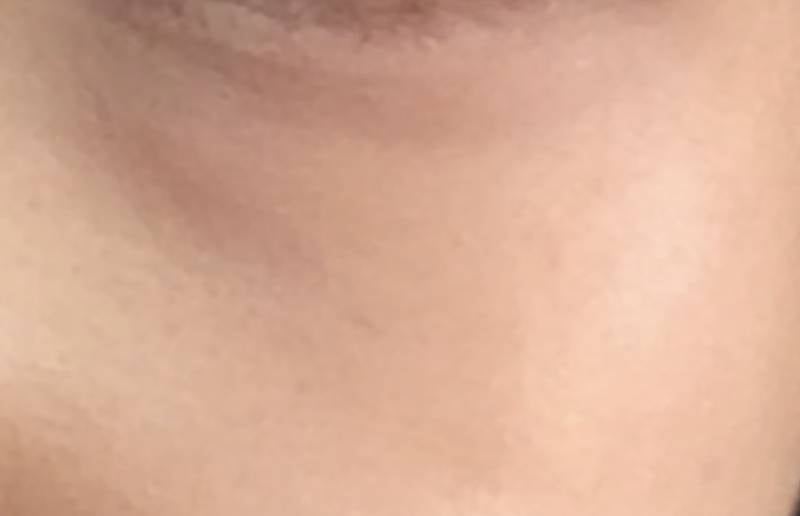 [잡담] 나 다크써클 겁나심한데 뭐해야 없어질까 | 인스티즈