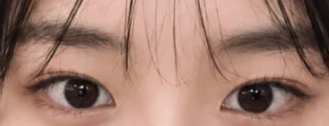 [잡담] 이 눈 이렇게 성형할 수 있을까? | 인스티즈