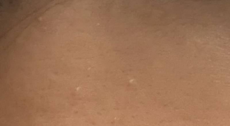 [잡담] 피부에 저런 하얀것들 올라오는데 뭐가문제인걸까…(ㅎㅇㅈㅇ) | 인스티즈