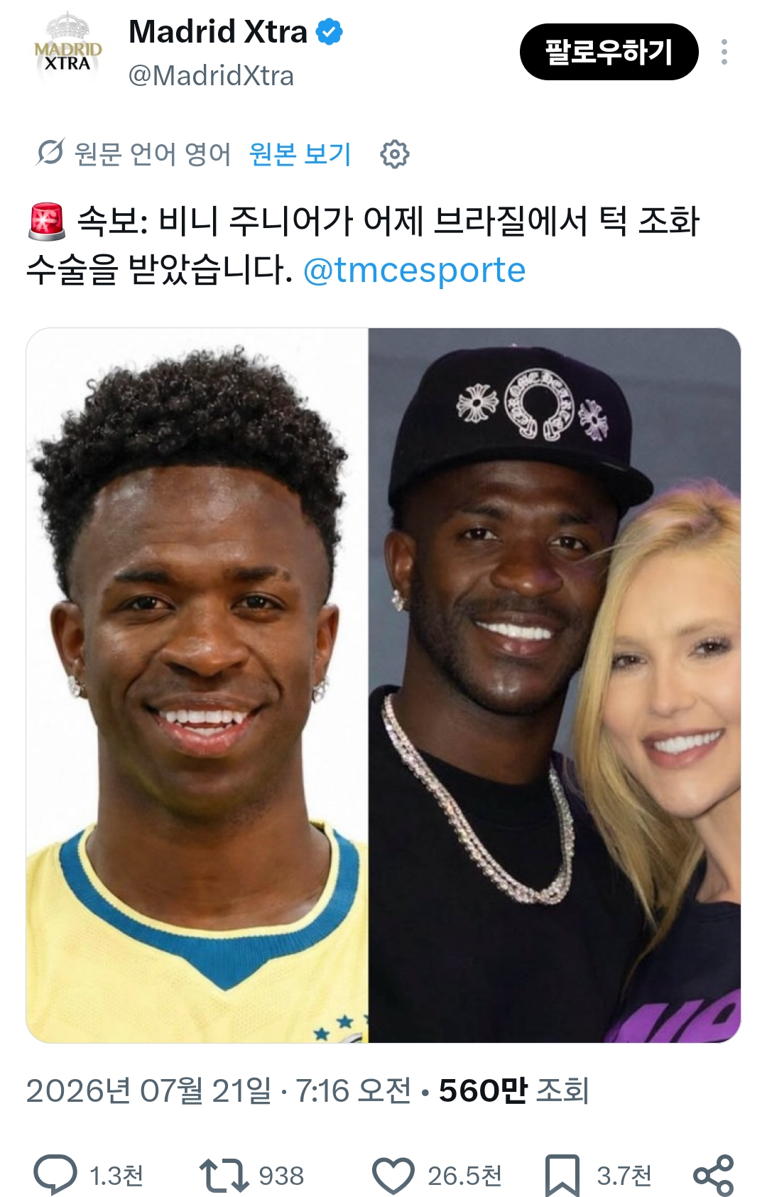 [정보/소식] 비니시우스 턱성형 | 인스티즈