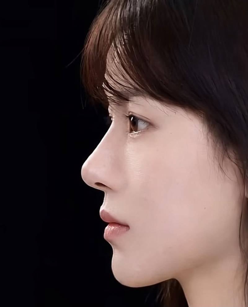 [잡담] 코수술 하면 진짜 이렇게 변해? | 인스티즈