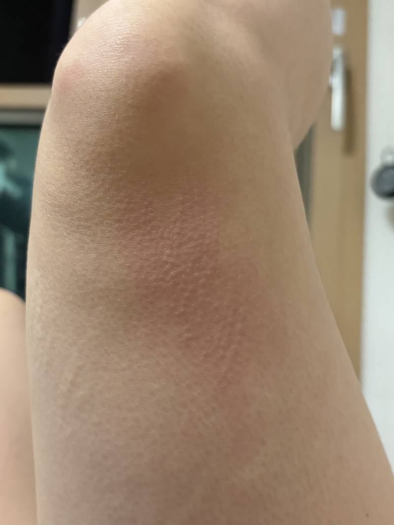 [잡담] (혐) 샤워하고나면 이렇게 올라오는데 왜그러는걸까ㅠㅠ | 인스티즈