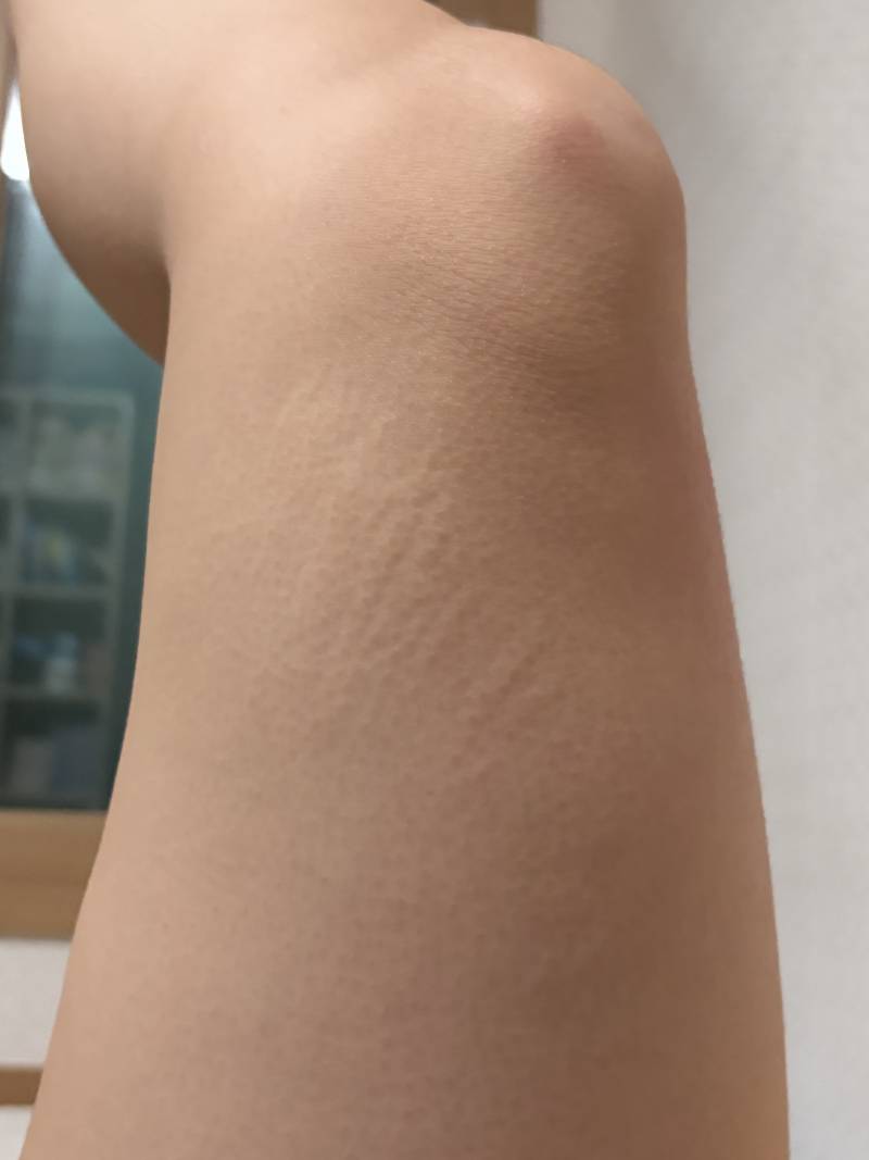[잡담] (혐) 샤워하고나면 이렇게 올라오는데 왜그러는걸까ㅠㅠ | 인스티즈