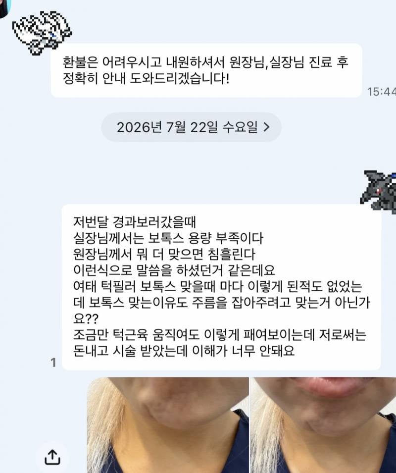 [잡담] 턱필러 턱보톡스 잘 아는사람 잇냐 ㅋㅋ | 인스티즈