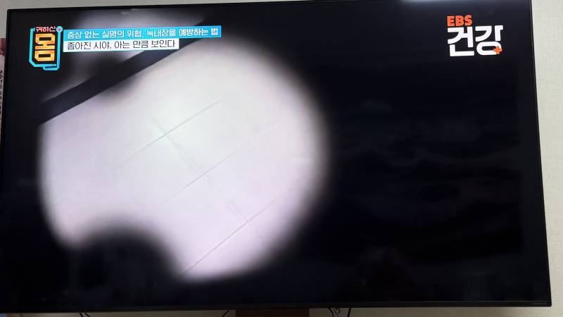 [잡담] 나 시야가 이런데 쟣된거임?? | 인스티즈