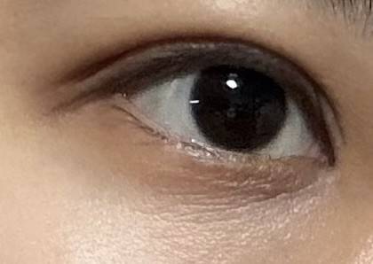 [잡담] 이런 눈 아래 주름은 어떻게 해? | 인스티즈