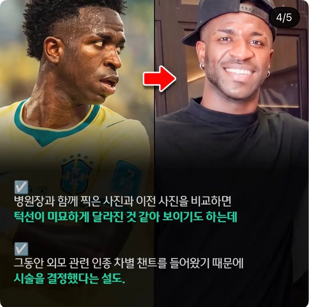 [잡담] 비니시우스 필러 맞았네 | 인스티즈