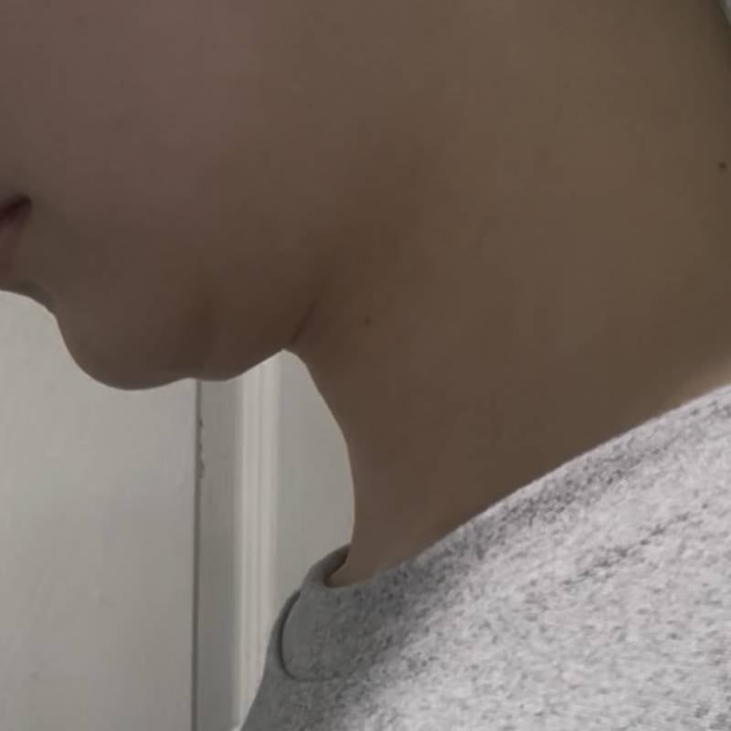 [잡담] 나 턱밑 많이 이상해?? | 인스티즈