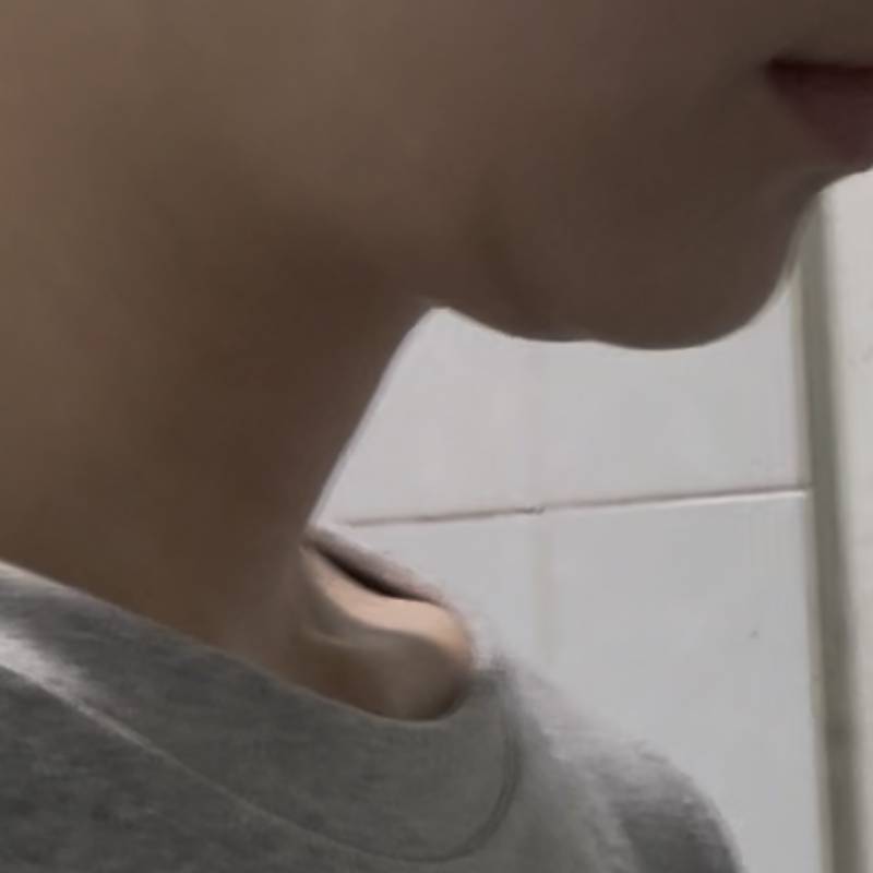 [잡담] 나 턱밑 많이 이상해?? | 인스티즈