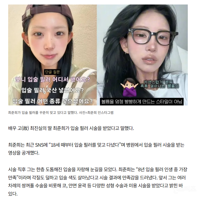 최준희, 또 달라진 얼굴? "18세 때부터 '이 시술' 받아” | 인스티즈