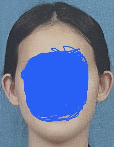 [잡담] 살빼면 얼굴형 예뻐질 수 있을까.. | 인스티즈