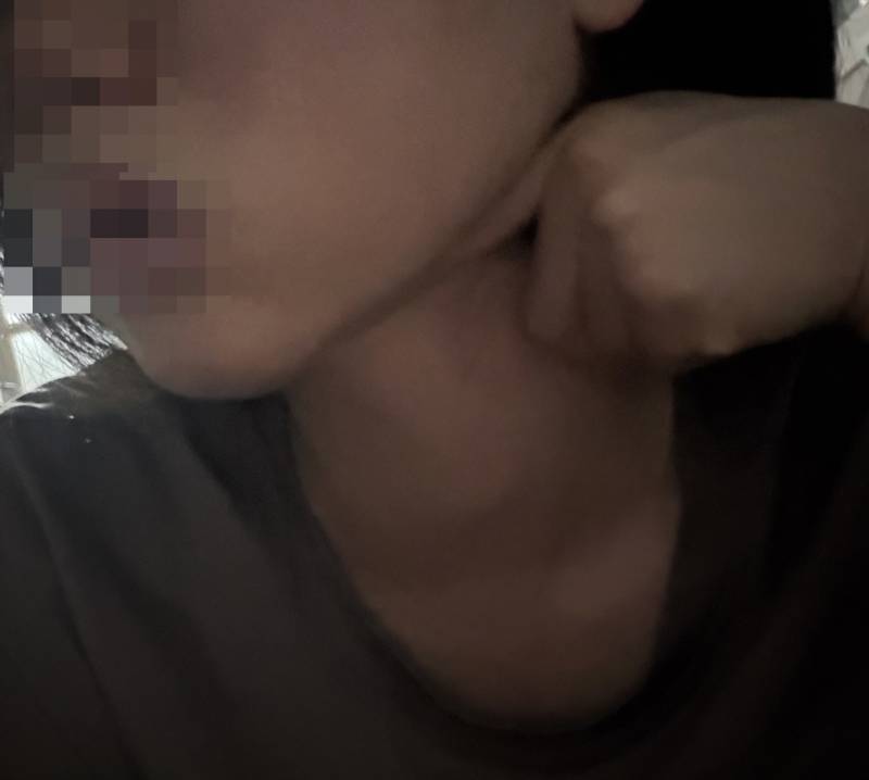 [잡담] 턱 밑살?? 이거 어케 없애…?? 사진봐줘 | 인스티즈