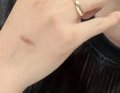 [잡담] 피의 게임 서출구 오늘 회차에서 게임하다가 다쳤네 | 인스티즈
