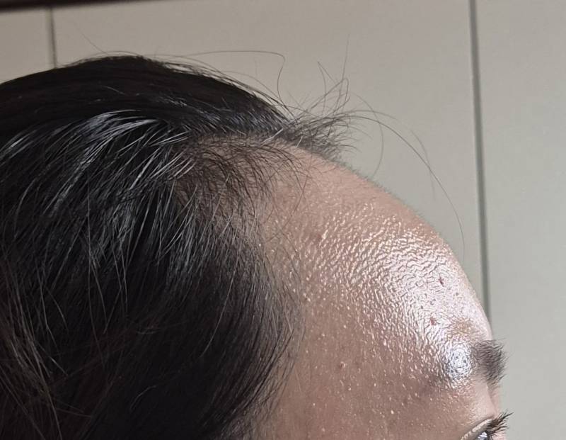 [잡담] 이거 헤어라인 m자인거 맞지? | 인스티즈