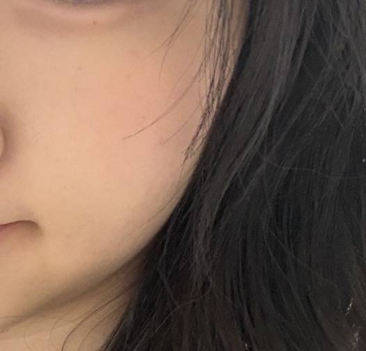 [잡담] 나도여드름진짜개개개심했는데 이젠좀꿀피부임 ㅎㅇㅈㅇ | 인스티즈