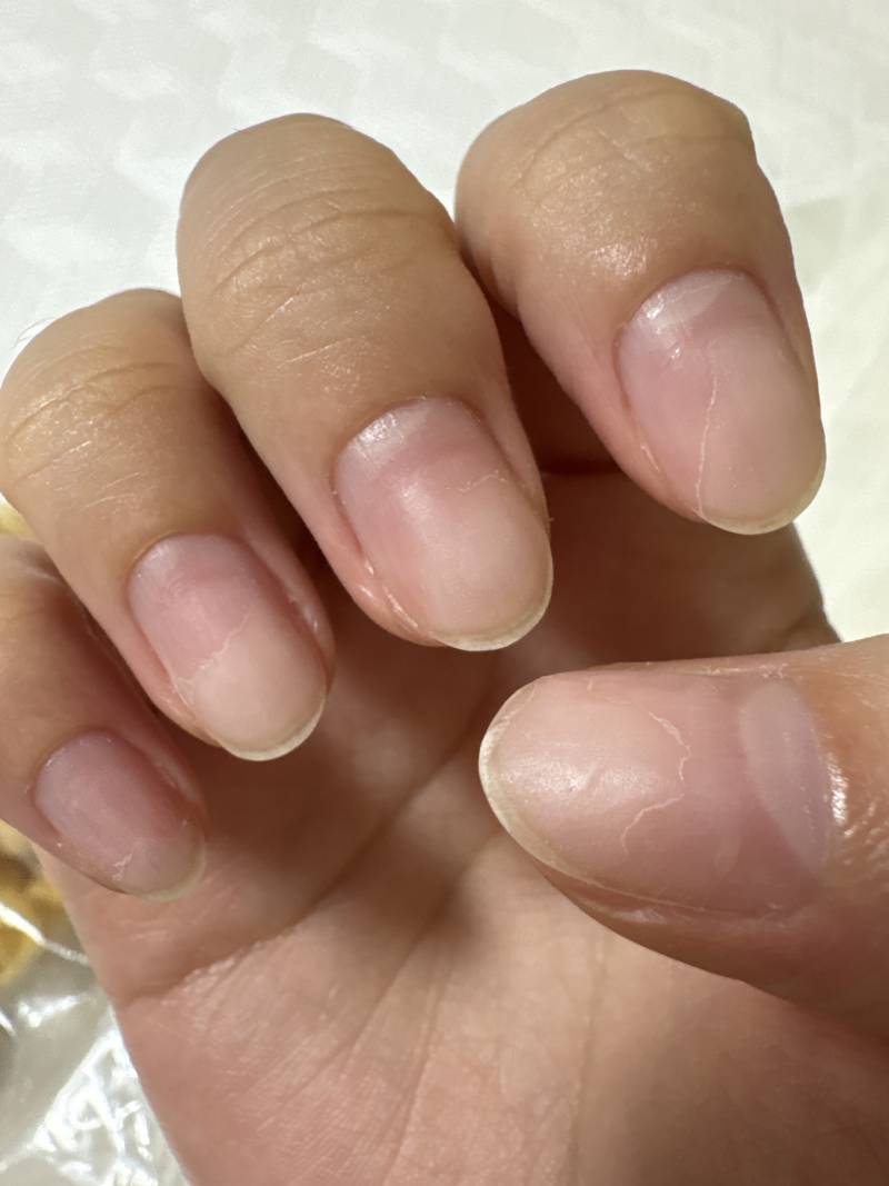 [잡담] 네일하고 손톱 얇아짐 | 인스티즈