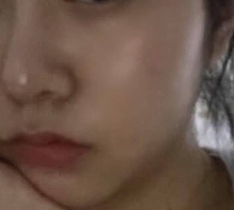 [잡담] 나도여드름진짜개개개심했는데 이젠좀꿀피부임 ㅎㅇㅈㅇ | 인스티즈