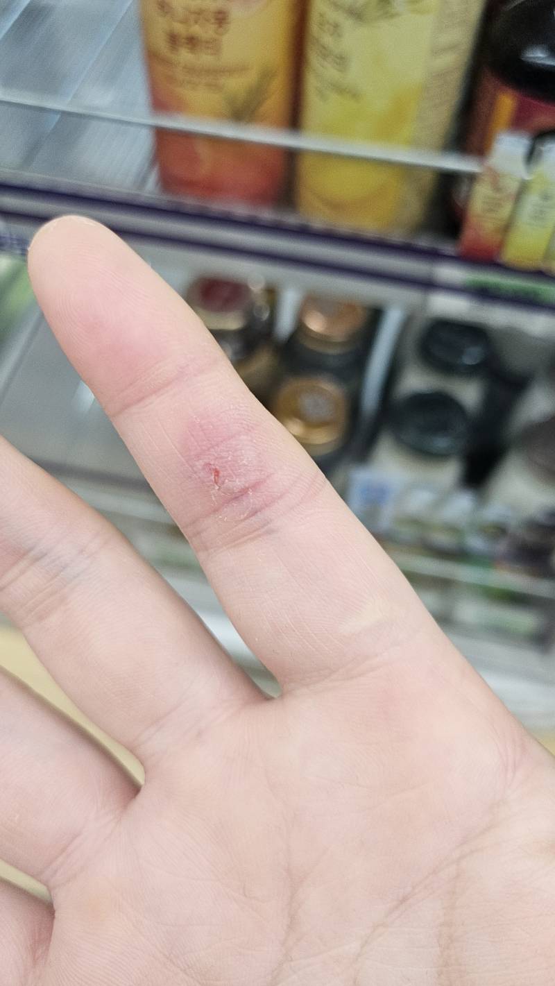 [잡담] 일하다가 부엇는데 너무아프다... | 인스티즈