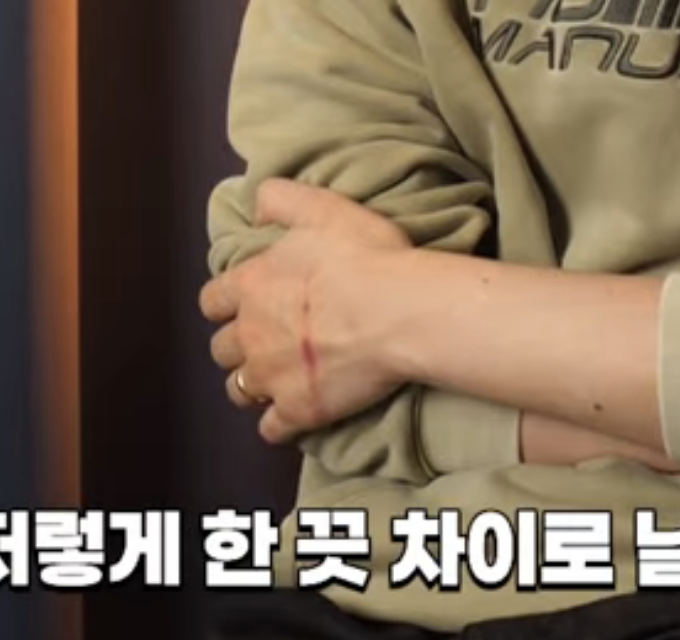 [잡담] 피겜 서출구 많이다치긴했다 | 인스티즈