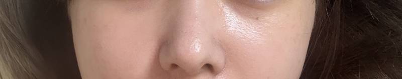 [잡담] 나 코에 고민있는데 | 인스티즈