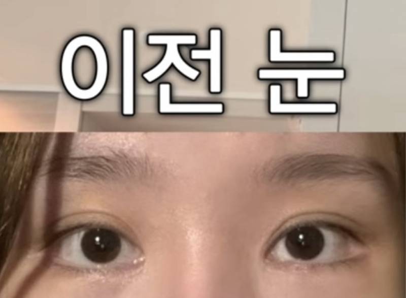 현재 또 얼굴에 손댔다고 밝힌 조두팔..JPG | 인스티즈
