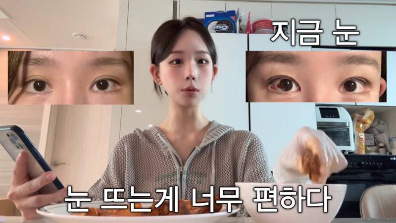 현재 또 얼굴에 손댔다고 밝힌 조두팔..JPG | 인스티즈