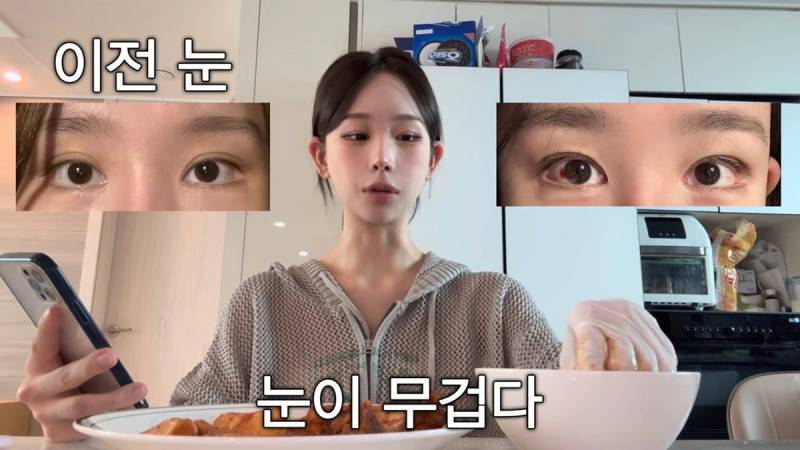 현재 또 얼굴에 손댔다고 밝힌 조두팔..JPG | 인스티즈