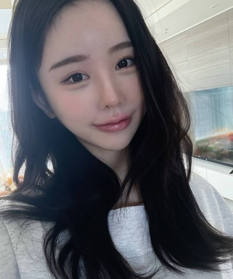 현재 또 얼굴에 손댔다고 밝힌 조두팔..JPG | 인스티즈