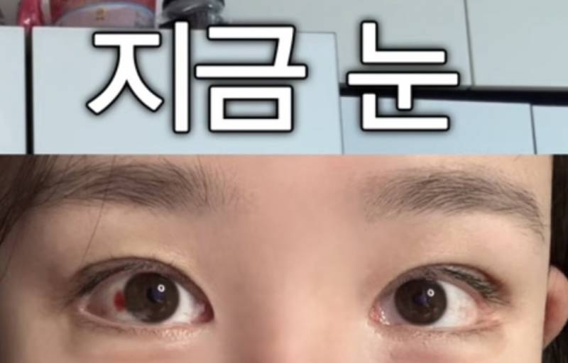 현재 또 얼굴에 손댔다고 밝힌 조두팔..JPG | 인스티즈