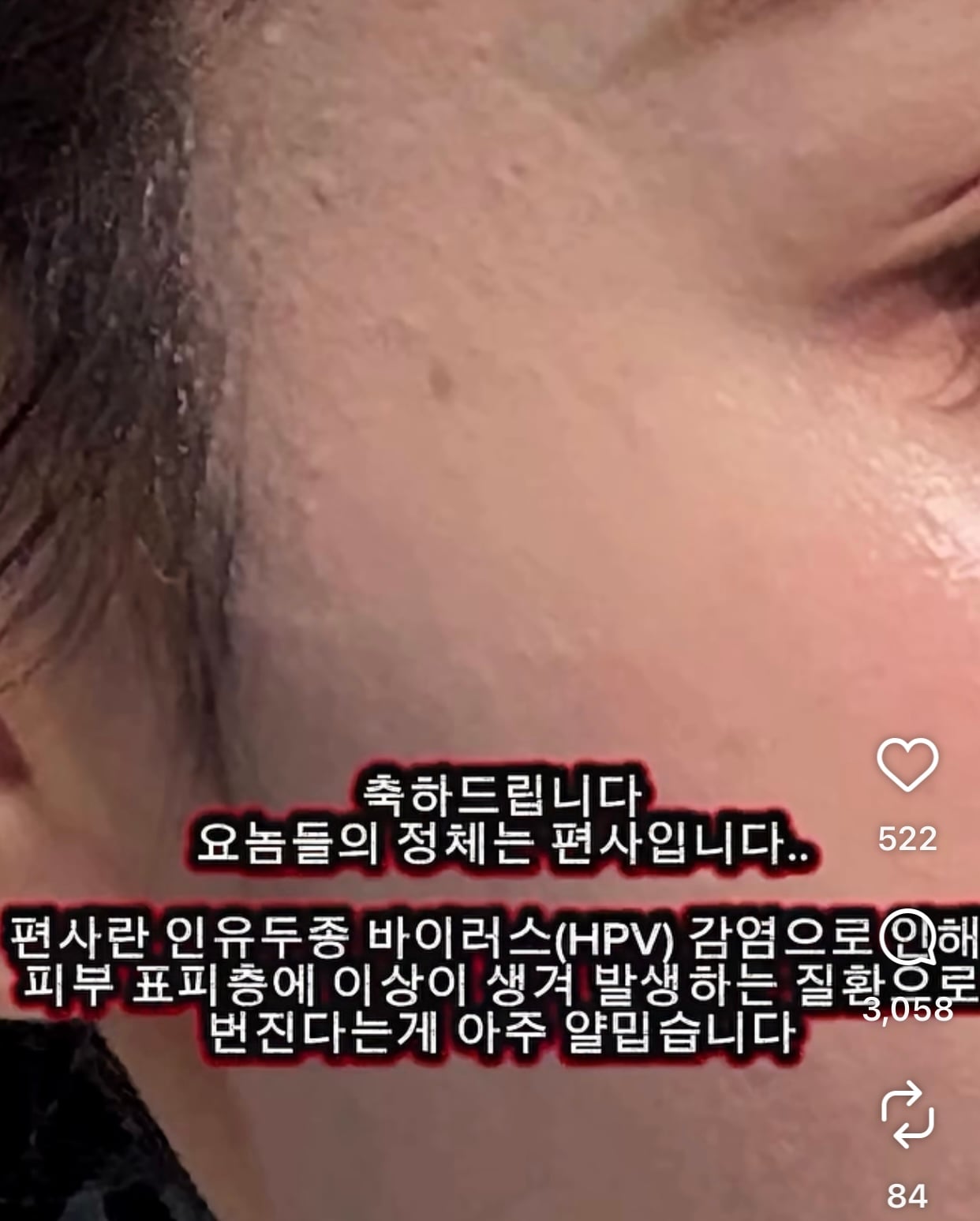 [잡담] 이런게 편평사마귀였다구…..? | 인스티즈