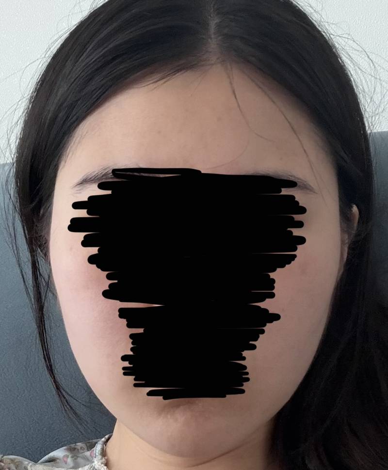 [잡담] 더 예뻐지고 싶은데 뭐해야할지 추천해줄사람 !! | 인스티즈