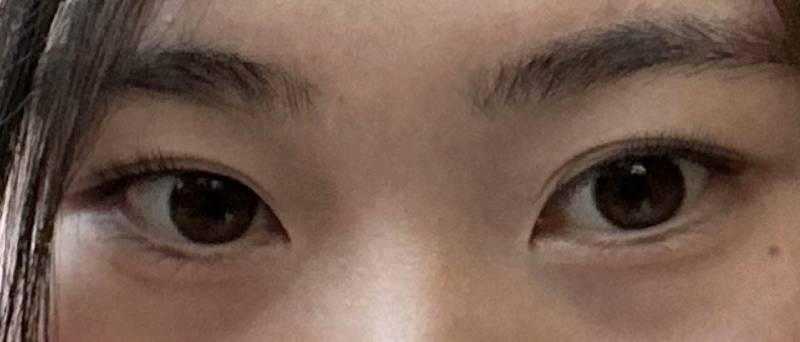 [잡담] 쌍커풀 전문가들 제발 나에게 힘을주세요 | 인스티즈
