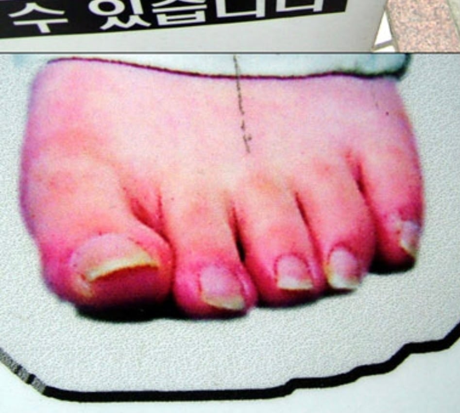 [잡담] 홍진호 발톱봐봐 ㅋㅋㅋ | 인스티즈