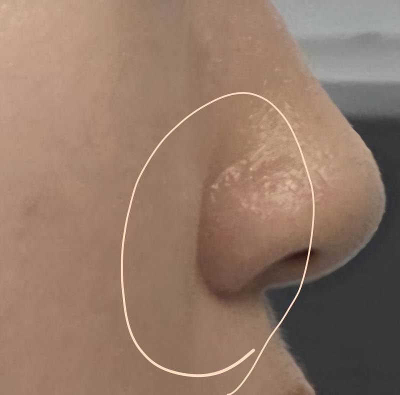 [잡담] 옆모습이건 리프팅이답이야? | 인스티즈