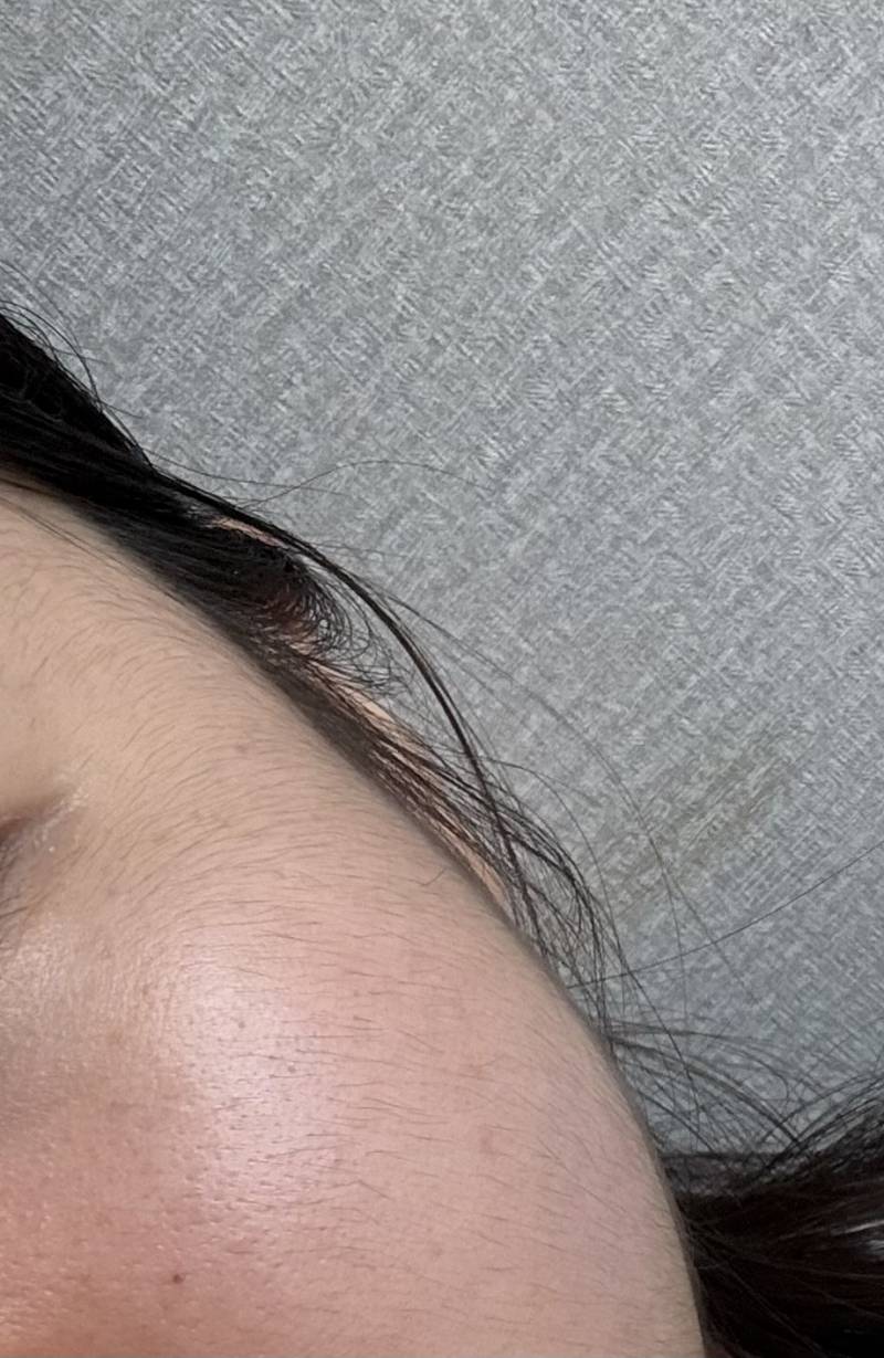 [잡담] 얼굴전체 레이저제뮤 20이던데 함해볼까.. | 인스티즈