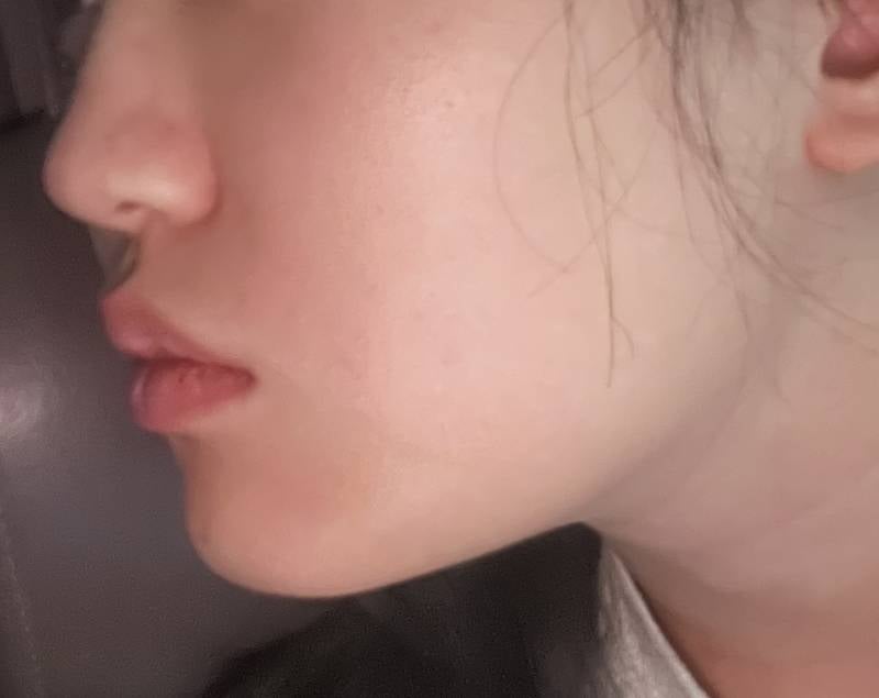 [잡담] 나 빼박 무턱이지ㅜ | 인스티즈