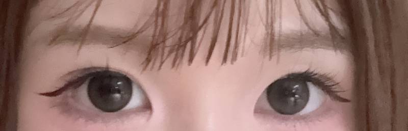 [잡담] 나 한쪽 눈만 앞트임 하면 삐꾸될까..?ㅠㅠㅠㅠ | 인스티즈